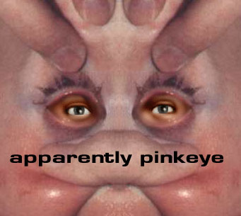 ../../IMBJR-33/apparently_pinkeye.JPG